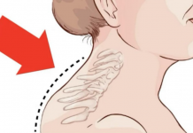 Kiropraktičar je pokazao 3 jednostavne vježbe koje će vam pomoći da uklonite “Grbu” u vratu: 0vo mi je najviše pomoglo! VIDEO