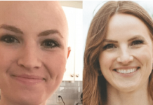 Liječnica pobijedila rak u trećoj fazi, savjetuje! PROŠIRIO SE SVUDA PO MENI, kupili mi gr0bno mjesto, otpisali me: ‘Jedite što više ove dvije namirnice i preživjet ćete’