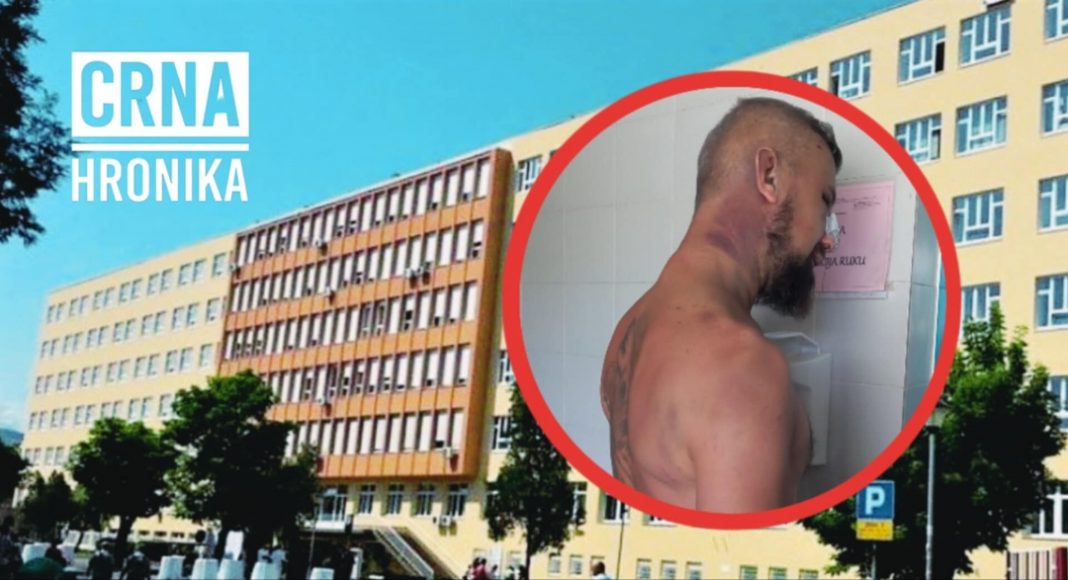 Alen Čeliković tvrdi da je mučen i pret’učen – završio na UKC-u Tuzla s teškim povredama: Tatini sinovi ga vezali, pa mu 0vo radili, na kraju poIicija privela njega, jer ih je “maItretirao” - featured image