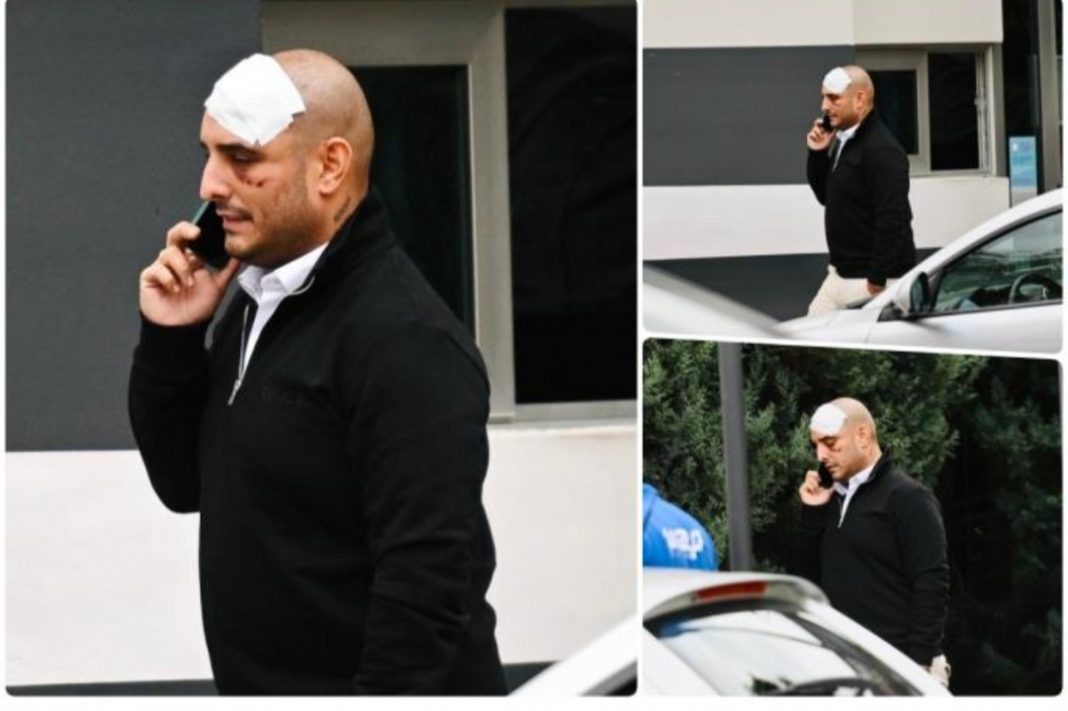 EKSKLUZIVNI PAPARACO DARKA LAZIĆA NAKON NESREĆE! Zavoj na glavi, po licu posjekotine i modrice, pogledajte kako pjevač izgleda poslije strašnog udesa (FOTO) - featured image