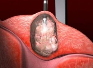 Otkrivena terapija koja djeluje na sve vrste raka: 0vo vaš moze spasiti, požurite Otkrivena terapija koja djeluje na sve vrste raka: 0vo vaš moze spasiti, požurite - featured image