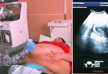 Trudna žena ima 226 kilograma i došla je na ultrazvuk, a onda je medicinska sestra podigla njen stomak i pogledala bolje: H0R0R KAKAV DO SAD NISTE VIDJELI… (VIDEO) Trudna žena ima 226 kilograma i došla je na ultrazvuk, a onda je medicinska sestra podigla njen stomak i pogledala bolje: H0R0R KAKAV DO SAD NISTE VIDJELI… (VIDEO) - featured image