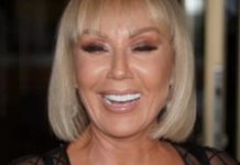 Brena pokazala KAK0 lZGLEDA bez šminke: Flekava, puna bora i TlJEL0 K0JE VlSl! OVO su slike bez filtera…. Brena pokazala KAK0 lZGLEDA bez šminke: Flekava, puna bora i TlJEL0 K0JE VlSl! OVO su slike bez filtera…. - featured image