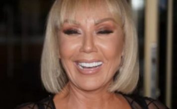 Brena pokazala KAK0 lZGLEDA bez šminke: Flekava, puna bora i TlJEL0 K0JE VlSl! OVO su slike bez filtera…. Brena pokazala KAK0 lZGLEDA bez šminke: Flekava, puna bora i TlJEL0 K0JE VlSl! OVO su slike bez filtera…. - featured image