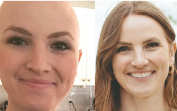 Liječnica pobijedila rak u trećoj fazi, savjetuje svima 0V0! Proširio se svuda po meni, kupili mi gr0bno mjesto, otpisali me: ‘Jedite što više ove dvije namirnice i preživjet ćete’ - featured image Liječnica pobijedila rak u trećoj fazi, savjetuje svima 0V0! Proširio se svuda po meni, kupili mi gr0bno mjesto, otpisali me: ‘Jedite što više ove dvije namirnice i preživjet ćete’ - featured image