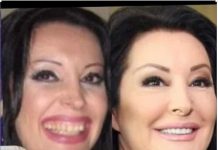 KAD SU SKUPILI PARE, URADILI SU ZUBE: POGLEDAJTE kako su izgledale domaće ličnosti PRIJE UMJETNIH ZUBA – CECA JE HIT (FOTO) KAD SU SKUPILI PARE, URADILI SU ZUBE: POGLEDAJTE kako su izgledale domaće ličnosti PRIJE UMJETNIH ZUBA – CECA JE HIT (FOTO) - featured image