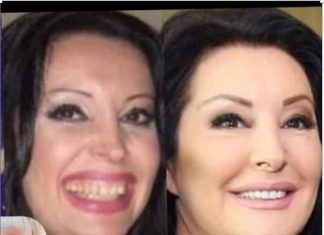 KAD SU SKUPILI PARE, URADILI SU ZUBE: POGLEDAJTE kako su izgledale domaće ličnosti PRIJE UMJETNIH ZUBA – CECA JE HIT (FOTO) KAD SU SKUPILI PARE, URADILI SU ZUBE: POGLEDAJTE kako su izgledale domaće ličnosti PRIJE UMJETNIH ZUBA – CECA JE HIT (FOTO) - featured image