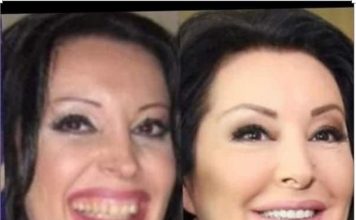 KAD SU SKUPILI PARE, URADILI SU ZUBE: POGLEDAJTE kako su izgledale domaće ličnosti PRIJE UMJETNIH ZUBA – CECA JE HIT (FOTO) KAD SU SKUPILI PARE, URADILI SU ZUBE: POGLEDAJTE kako su izgledale domaće ličnosti PRIJE UMJETNIH ZUBA – CECA JE HIT (FOTO) - featured image