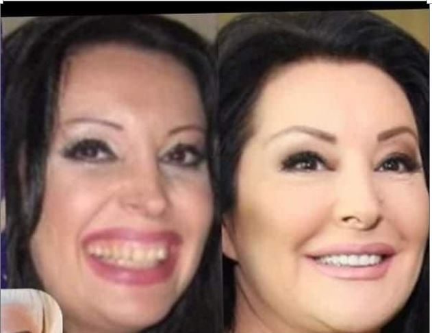 KAD SU SKUPILI PARE, URADILI SU ZUBE: POGLEDAJTE kako su izgledale domaće ličnosti PRIJE UMJETNIH ZUBA – CECA JE HIT (FOTO) KAD SU SKUPILI PARE, URADILI SU ZUBE: POGLEDAJTE kako su izgledale domaće ličnosti PRIJE UMJETNIH ZUBA – CECA JE HIT (FOTO) - featured image