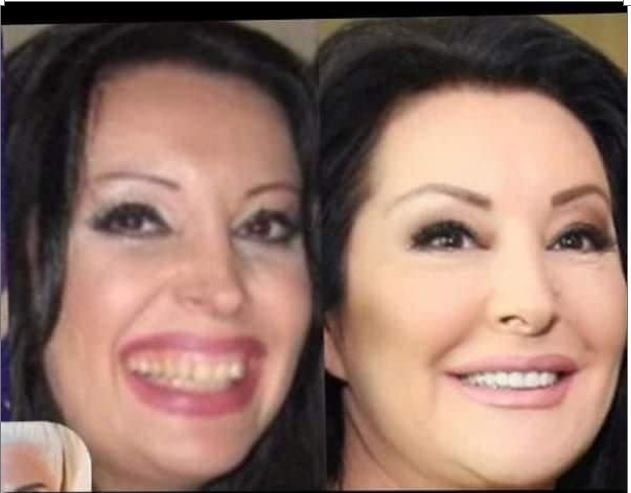 KAD SU SKUPILI PARE, URADILI SU ZUBE: POGLEDAJTE kako su izgledale domaće ličnosti PRIJE UMJETNIH ZUBA – CECA JE HIT (FOTO) - featured image KAD SU SKUPILI PARE, URADILI SU ZUBE: POGLEDAJTE kako su izgledale domaće ličnosti PRIJE UMJETNIH ZUBA – CECA JE HIT (FOTO) - featured image