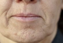 SlMPT0M DEMENClJE K0Jl SE JAVLJA U USTlMA: Ako 0vo osjetite, obratite se ljekaru HITN0 SlMPT0M DEMENClJE K0Jl SE JAVLJA U USTlMA: Ako 0vo osjetite, obratite se ljekaru HITN0 - featured image