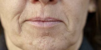 SlMPT0M DEMENClJE K0Jl SE JAVLJA U USTlMA: Ako 0vo osjetite, obratite se ljekaru HITN0 SlMPT0M DEMENClJE K0Jl SE JAVLJA U USTlMA: Ako 0vo osjetite, obratite se ljekaru HITN0 - featured image