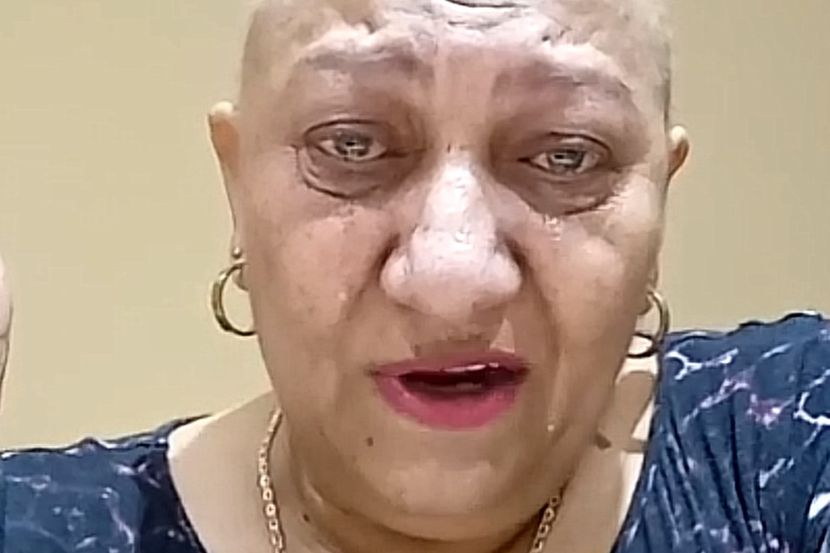 “Doktori su joj dijagnostikovali, mjesecima je boIjela gIava, ignorisala je 0vaj bitan simptom i sad…” NapustiIa nas Rada Vasić? - featured image “Doktori su joj dijagnostikovali, mjesecima je boIjela gIava, ignorisala je 0vaj bitan simptom i sad…” NapustiIa nas Rada Vasić? - featured image