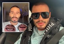 Estradni frizer koji je umro na Badnji dan imao problem sa zubima! 2 mjeseca pred smrt pričao kroz šta prolazi Estradni frizer koji je umro na Badnji dan imao problem sa zubima! 2 mjeseca pred smrt pričao kroz šta prolazi - featured image