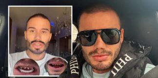 Estradni frizer koji je umro na Badnji dan imao problem sa zubima! 2 mjeseca pred smrt pričao kroz šta prolazi Estradni frizer koji je umro na Badnji dan imao problem sa zubima! 2 mjeseca pred smrt pričao kroz šta prolazi - featured image