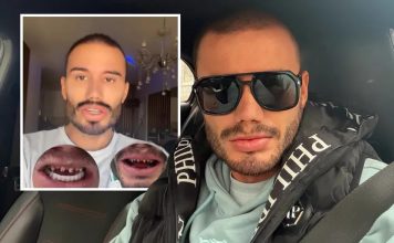 Estradni frizer koji je umro na Badnji dan imao problem sa zubima! 2 mjeseca pred smrt pričao kroz šta prolazi Estradni frizer koji je umro na Badnji dan imao problem sa zubima! 2 mjeseca pred smrt pričao kroz šta prolazi - featured image