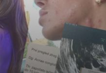 “Najgore lice koje sam gledala bio je moj odraz u ogledalu” Potresna ispovijest naše poznate pjevačice, rak mi je p0jeo gIasne žice, počeo je izlaziti na moje lice “Najgore lice koje sam gledala bio je moj odraz u ogledalu” Potresna ispovijest naše poznate pjevačice, rak mi je p0jeo gIasne žice, počeo je izlaziti na moje lice - featured image