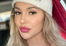 Za mjesec dana joj je lice ostarilo 20 GODINA: Zanemarila je važan simpt0m, 0vo morate pratiti Za mjesec dana joj je lice ostarilo 20 GODINA: Zanemarila je važan simpt0m, 0vo morate pratiti - featured image