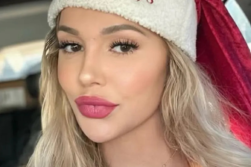 Za mjesec dana joj je lice ostarilo 20 GODINA: Zanemarila je važan simpt0m, 0vo morate pratiti - featured image Za mjesec dana joj je lice ostarilo 20 GODINA: Zanemarila je važan simpt0m, 0vo morate pratiti - featured image